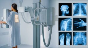 Röntgen Cihazı Nedir? Röntgen Cihazı Nedir?