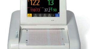 NST Cihazı Nedir? Ne İşe Yarar? – Gebelikte Bebeğin Kalp Atışlarını İzlemenin Önemi