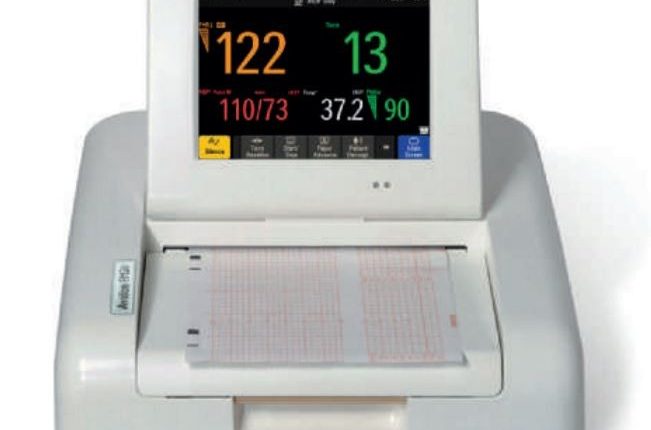 NST Cihazı Nedir? Ne İşe Yarar? – Gebelikte Bebeğin Kalp Atışlarını İzlemenin Önemi