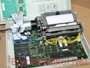 EKG Cihazlarında Teknik Hata Kodları, Kullanıcı Kaynaklı Sinyal Bozuklukları ve Klinik Biyomedikal Bakım Standartları