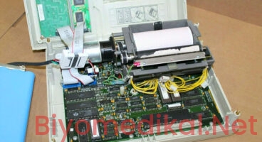 EKG Cihazlarında Teknik Hata Kodları, Kullanıcı Kaynaklı Sinyal Bozuklukları ve Klinik Biyomedikal Bakım Standartları