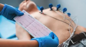 EKG Cihazlarında Sinyal Bütünlüğü, Parazit Önleme Stratejileri ve Elektrod Yerleşim Protokolleri