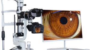 Biyomikroskop (Slit Lamp) Cihazı Nedir? Hangi Alanlarda Hangi Amaçlarda Kullanılır?